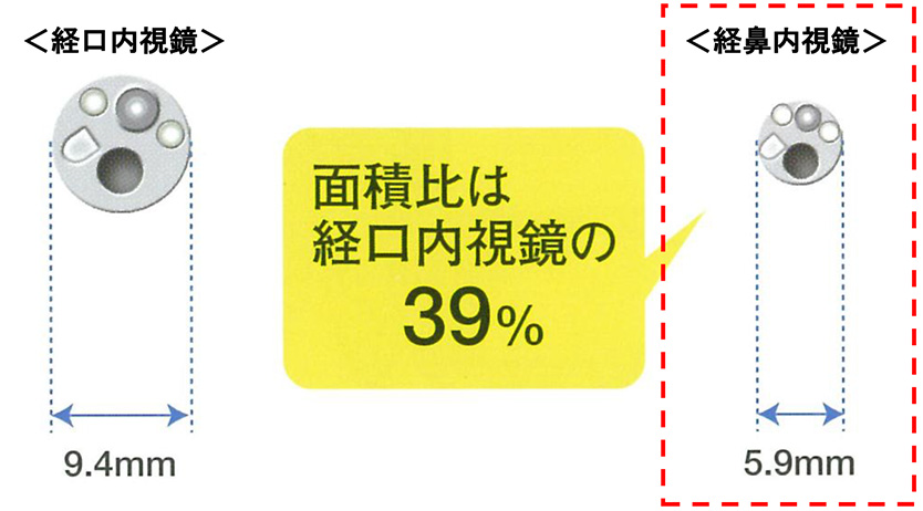 面積比は経口内視鏡の39%